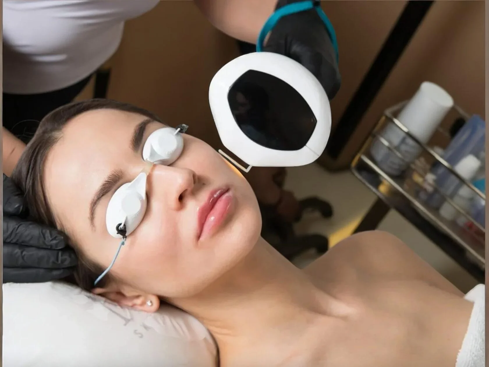 Фотоомоложение кожи