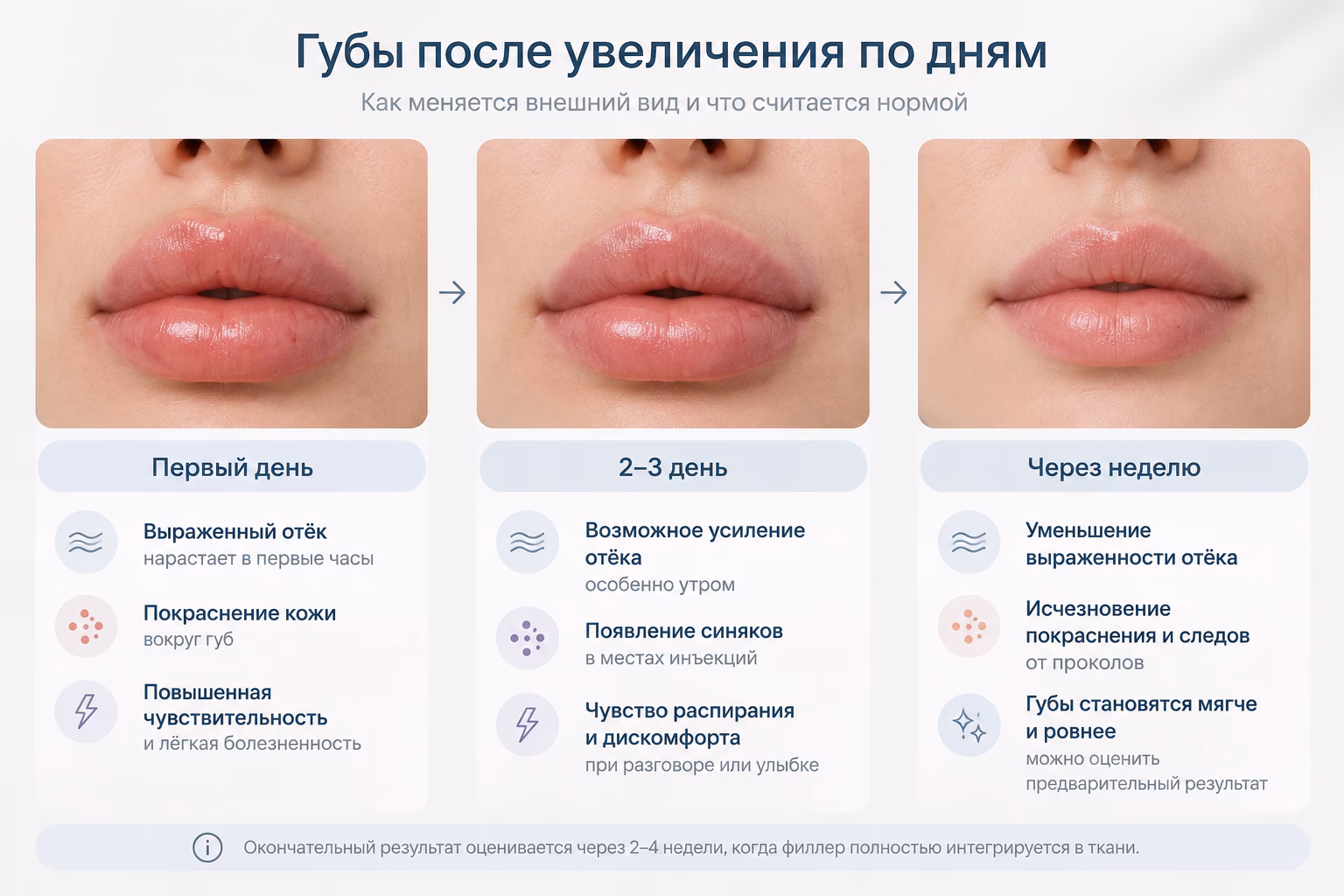 Губы после увеличения по дням